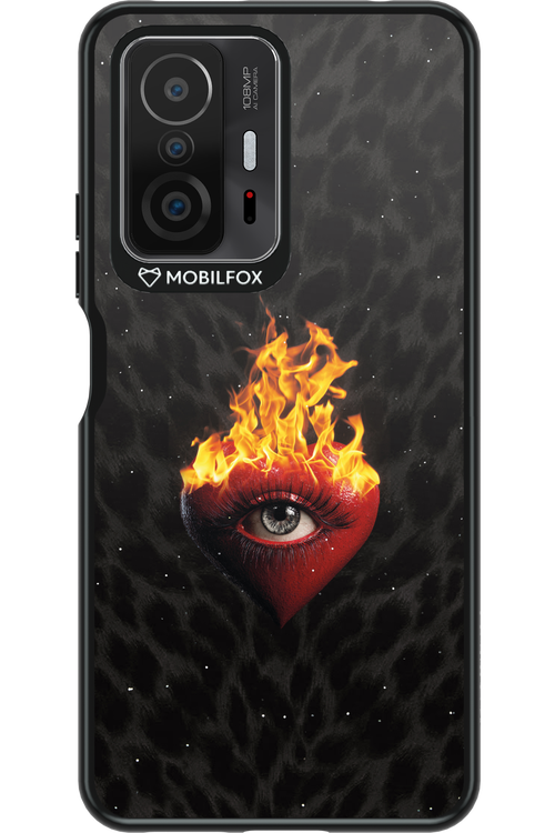 Shit happens - Xiaomi Mi 11T