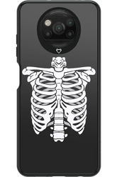 SKELETON - Xiaomi Poco X3 NFC