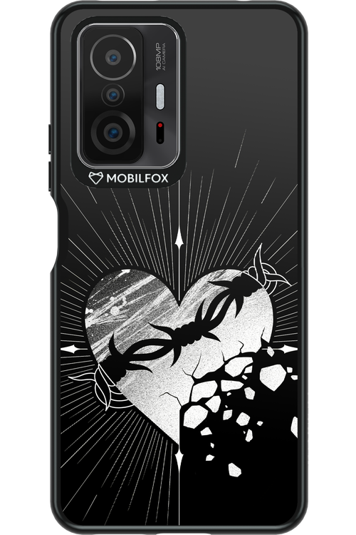 Fehér Szív - Xiaomi Mi 11T