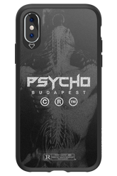 X-Ray - Apple iPhone X