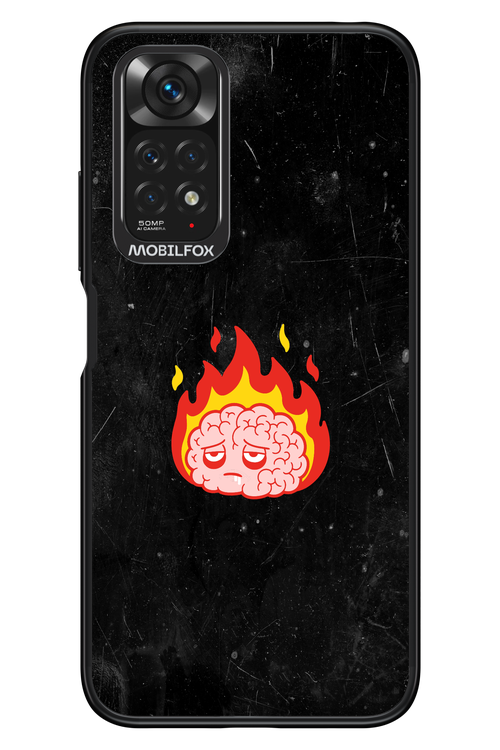 My brain - Xiaomi Redmi Note 11/11S 4G