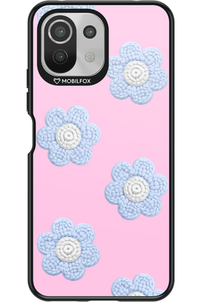 Baby Pink - Xiaomi Mi 11 Lite (2021)