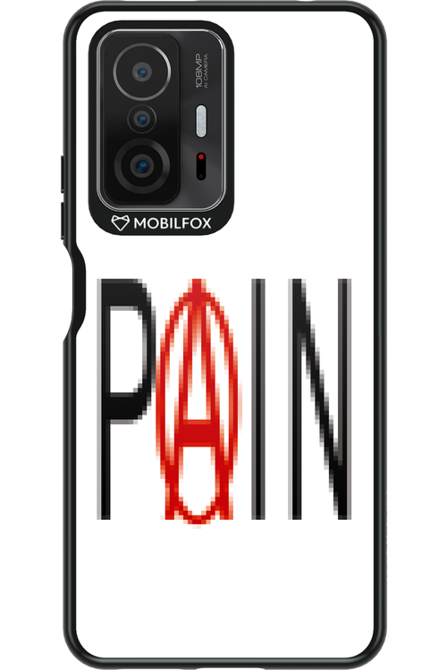 PAIN 2.0 - Xiaomi Mi 11T