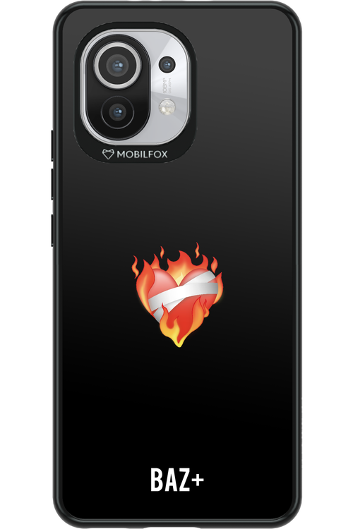 BAZ+ - Xiaomi Mi 11 5G