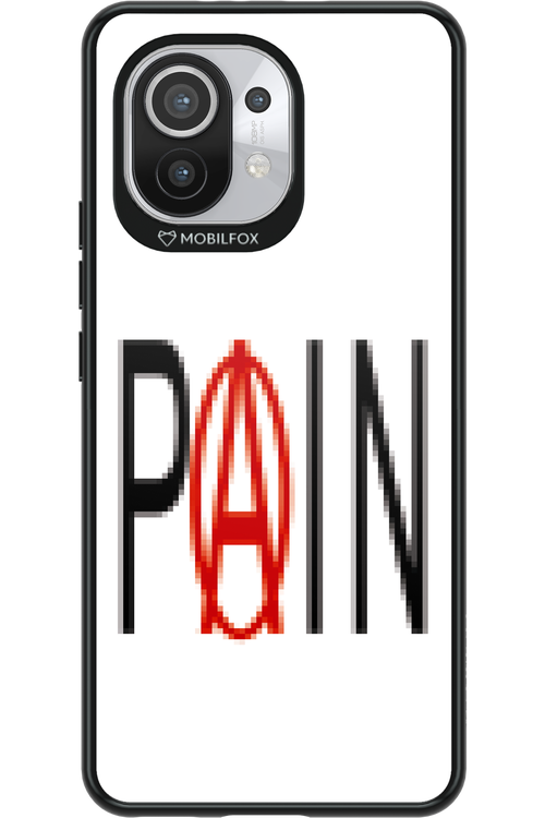 PAIN 2.0 - Xiaomi Mi 11 5G