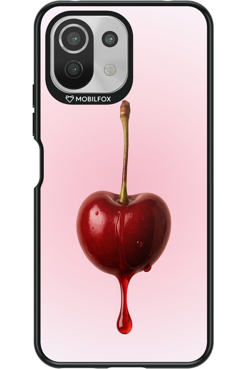 Cherry Babe - Xiaomi Mi 11 Lite (2021)