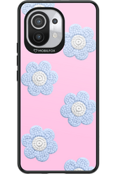 Baby Pink - Xiaomi Mi 11 5G