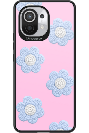 Baby Pink - Xiaomi Mi 11 5G