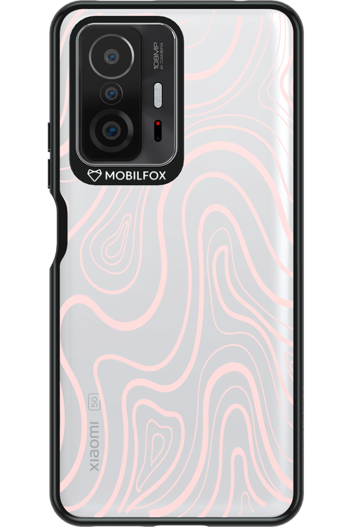 Topo Calm - Xiaomi Mi 11T