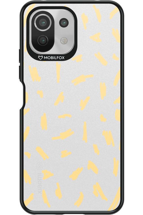 Fries Please - Xiaomi Mi 11 Lite (2021)