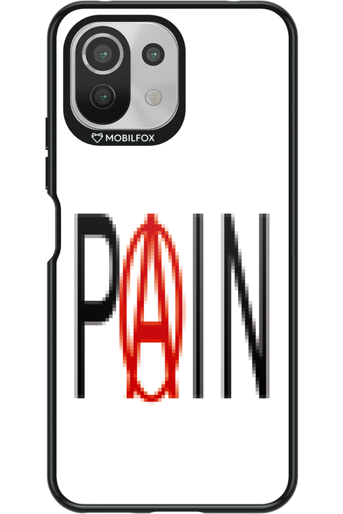 PAIN 2.0 - Xiaomi Mi 11 Lite (2021)