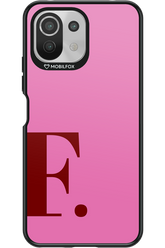 F (Sorbet) 2.0 - Xiaomi Mi 11 Lite (2021)
