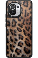 Furr Babe - Xiaomi Mi 11 5G