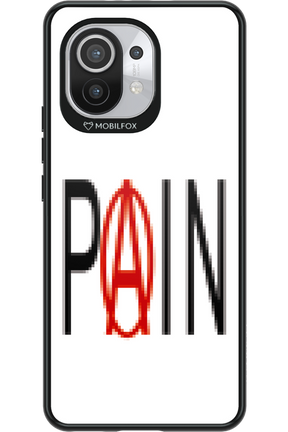 PAIN 2.0 - Xiaomi Mi 11 5G
