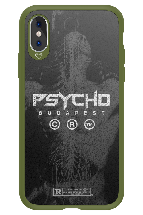 X-Ray - Apple iPhone X