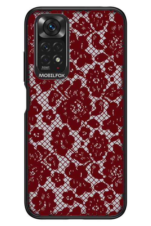 Lace Lover - Xiaomi Redmi Note 11/11S 4G