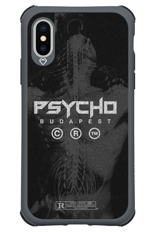 X-Ray - Apple iPhone X