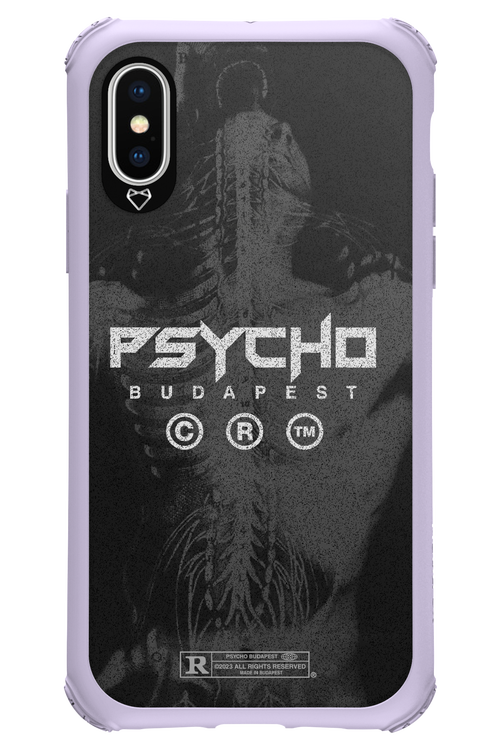 X-Ray - Apple iPhone X