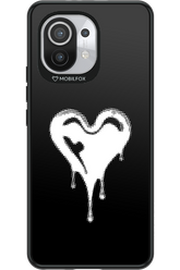 Heart Black - Xiaomi Mi 11 5G