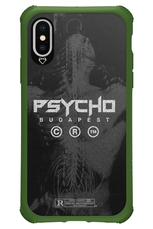 X-Ray - Apple iPhone X
