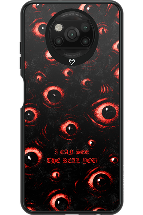 The Watchers - Xiaomi Poco X3 NFC