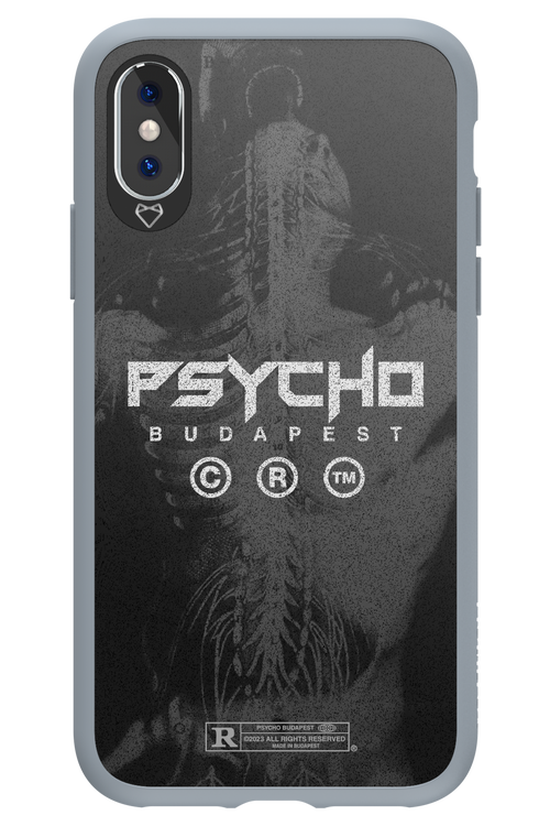 X-Ray - Apple iPhone X