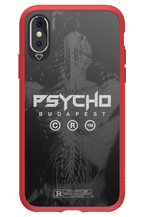 X-Ray - Apple iPhone X