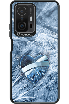 Ice 2.0 - Xiaomi Mi 11T Pro