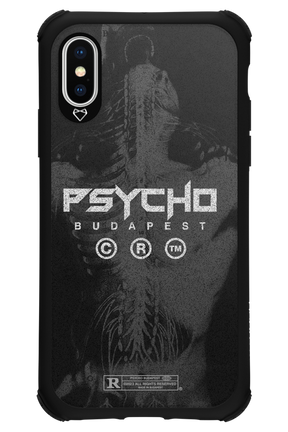 X-Ray - Apple iPhone X