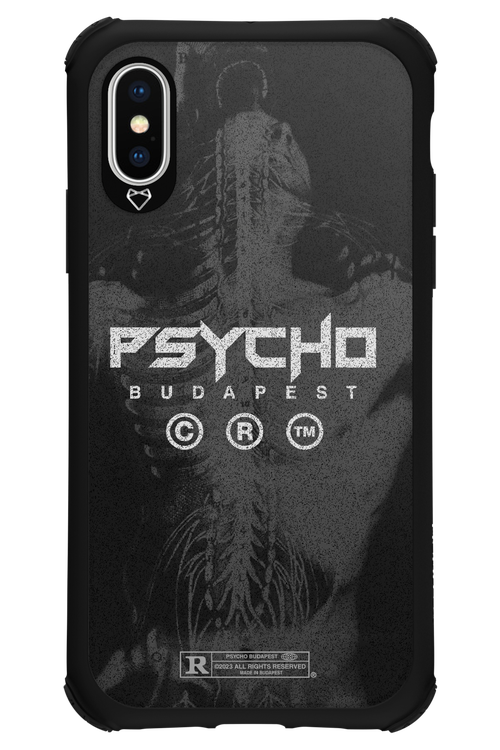 X-Ray - Apple iPhone X
