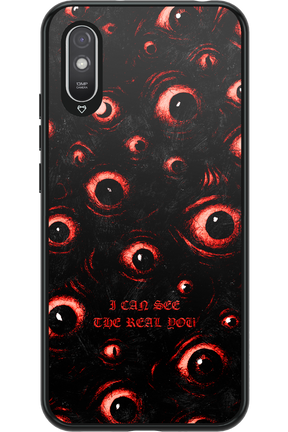 The Watchers - Xiaomi Redmi 9A