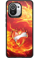 Fire - Xiaomi Mi 11 5G