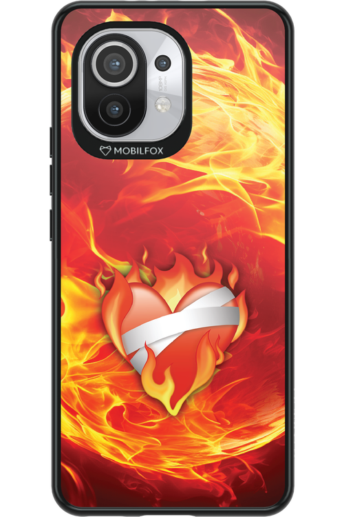 Fire - Xiaomi Mi 11 5G