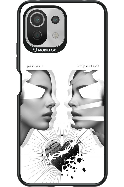 Arcok 2.0 - Xiaomi Mi 11 Lite (2021)
