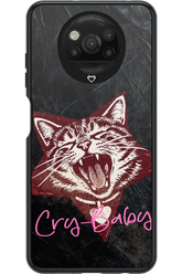Cry-Baby 2.0 - Xiaomi Poco X3 Pro