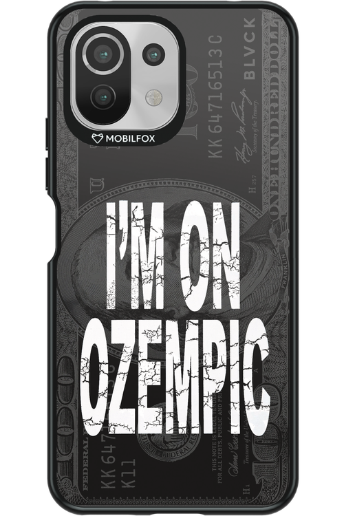 ozempic 2.0 - Xiaomi Mi 11 Lite (2021)