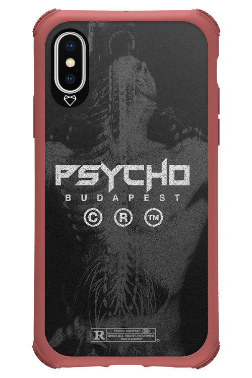 X-Ray - Apple iPhone X