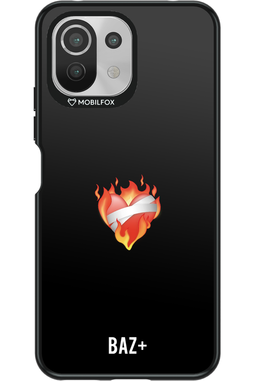 BAZ+ - Xiaomi Mi 11 Lite (2021)