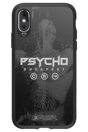 X-Ray - Apple iPhone X