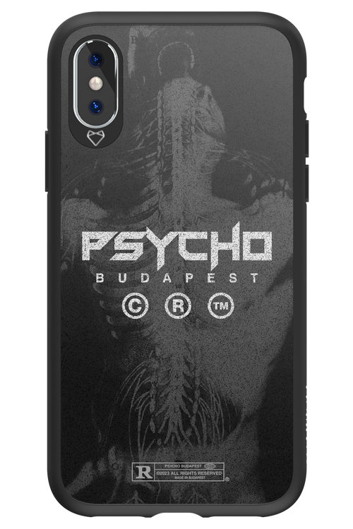 X-Ray - Apple iPhone X