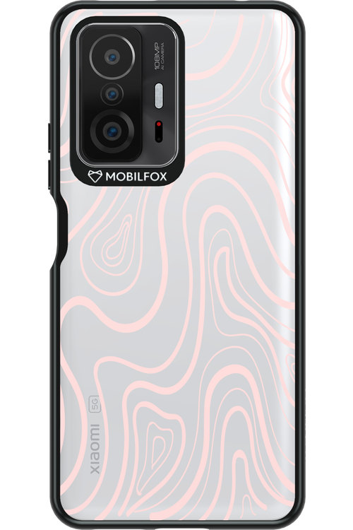 Topo Calm - Xiaomi Mi 11T Pro