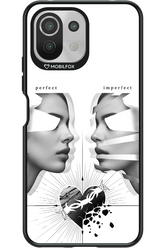 Arcok 2.0 - Xiaomi Mi 11 Lite (2021)