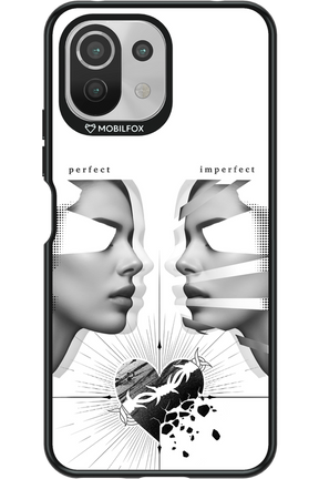Arcok 2.0 - Xiaomi Mi 11 Lite (2021)