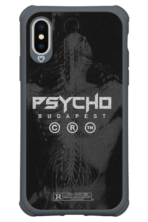 X-Ray - Apple iPhone X