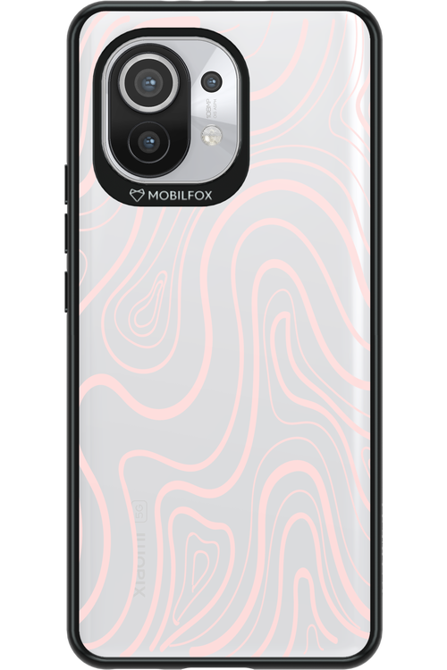 Topo Calm - Xiaomi Mi 11 5G