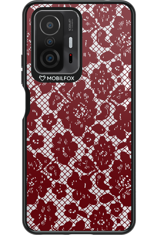Lace Lover - Xiaomi Mi 11T