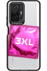 3XL 2.0 - Xiaomi Mi 11T