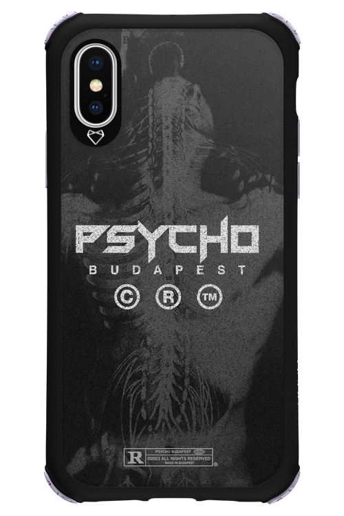 X-Ray - Apple iPhone X