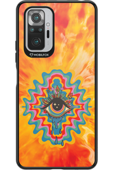 ThirdEye 2.0 - Xiaomi Redmi Note 10S