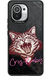 Cry-Baby 2.0 - Xiaomi Mi 11 5G